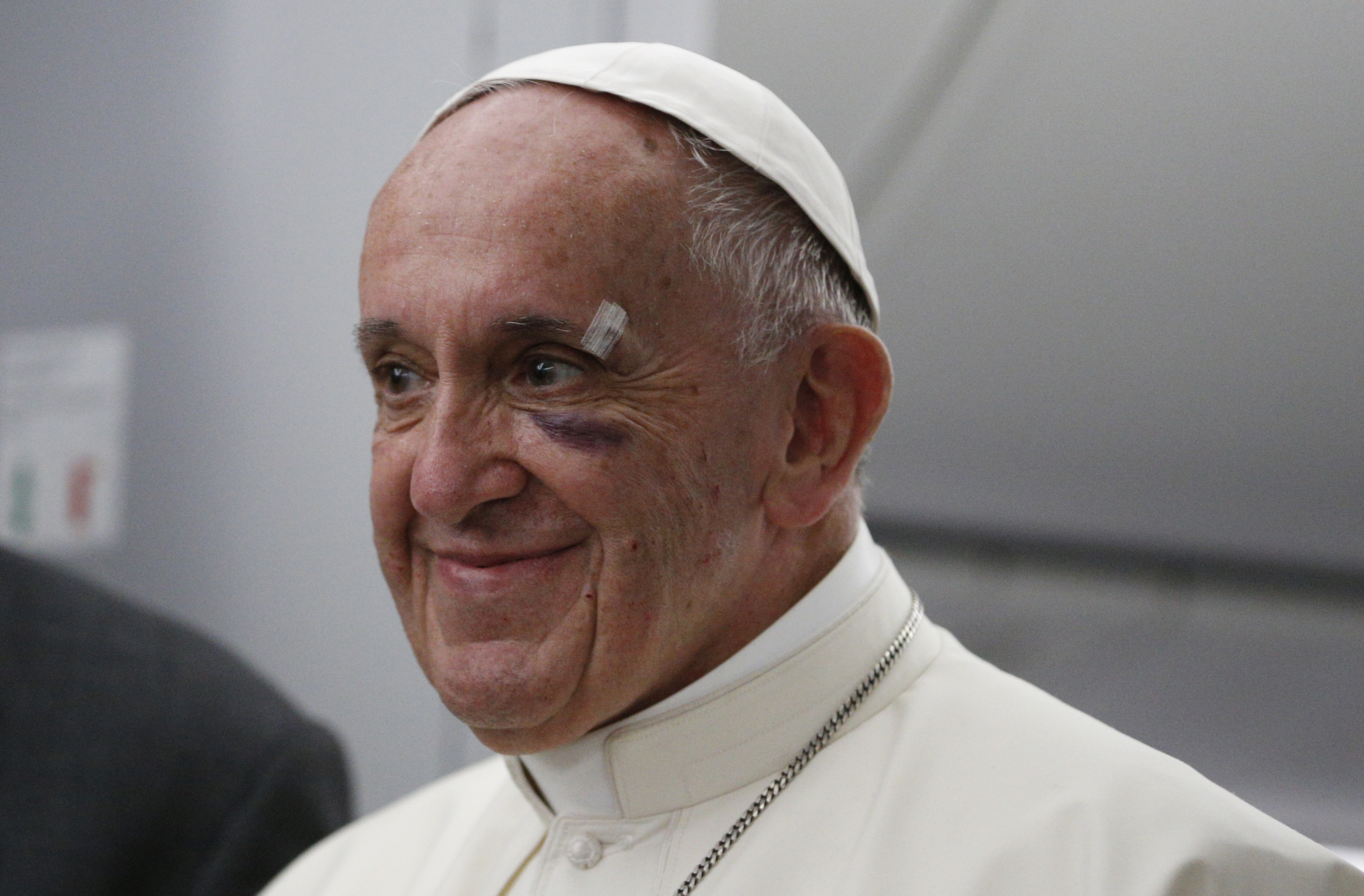 Pope Francis' black eye tells us a lot about the church today | America  Magazine