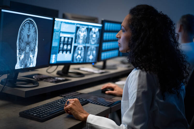 Side view of female radiologist looking at the MRI image of the head on her monitor and analysing it. (iStock/simonkr)